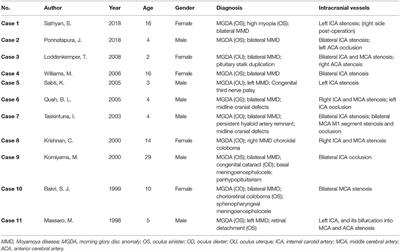 Moyamoya Disease Associated With Morning Glory Disc Anomaly and Other Ophthalmic Findings: A Mini-Review